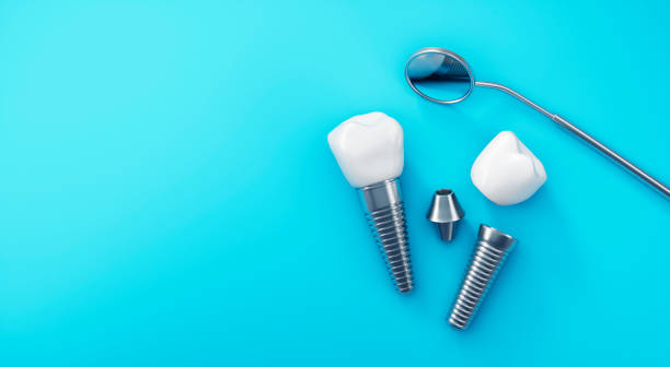 Two dental implants lay flat on a light blue surface